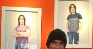 Glioblastoma, Kanker Otak yang “Membunuh” Agung Hercules