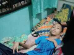 Akbar, Bocah Penderita Kanker di Batam Butuh Uluran Tangan