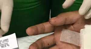 Gara-Gara Gas Motor, Oknum Brimob Tembak Pemuda di Batam Oknum Brimob Tembak Pemuda di Batam