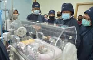 Asa Bayi Penderita Herlequine Ichtyosys di Batam, Mencari Obat yang Belum Ada di Indonesia Bayi