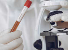 UGM Bikin GeNose, Bisa Deteksi Corona dalam 80 Detik UGM Bikin GeNose