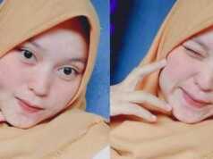 Gadis Cantik 17 Tahun Meninggal Dunia Sehari Jelang Pernikahan Gadis Meninggal