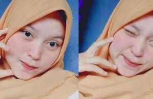 Gadis Cantik 17 Tahun Meninggal Dunia Sehari Jelang Pernikahan Gadis Meninggal