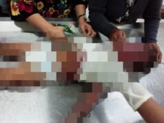 Sempat Dirawat di RSUD, Balita Korban Mobil Terbakar di SPBU Meninggal Balita Terbakar di Batam