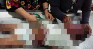 Sempat Dirawat di RSUD, Balita Korban Mobil Terbakar di SPBU Meninggal Balita Terbakar di Batam