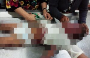 Sempat Dirawat di RSUD, Balita Korban Mobil Terbakar di SPBU Meninggal Balita Terbakar di Batam